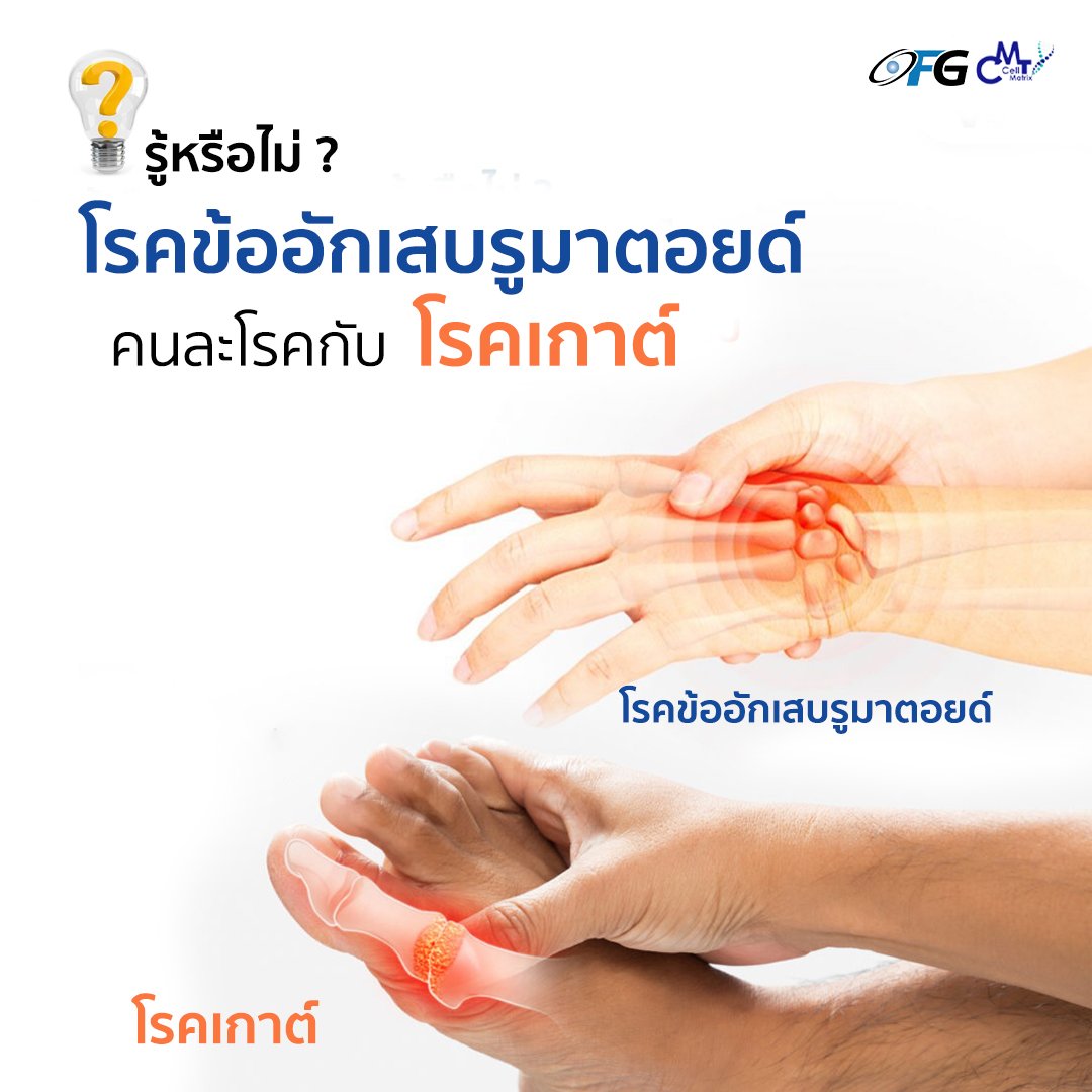 รู้หรือไม่ ? โรคข้ออักเสบรูมาตอยด์ คนละโรคกับโรคเกาต์