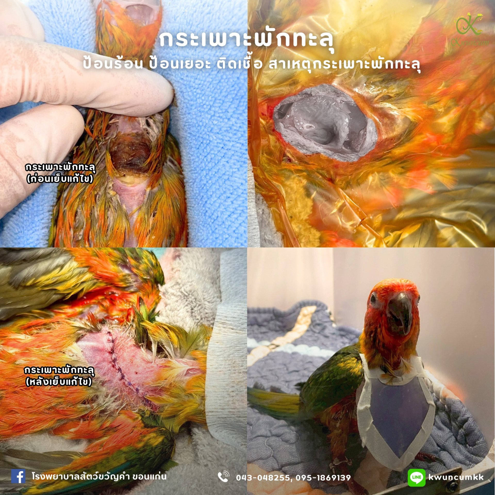 กระเพาะพักทะลุ