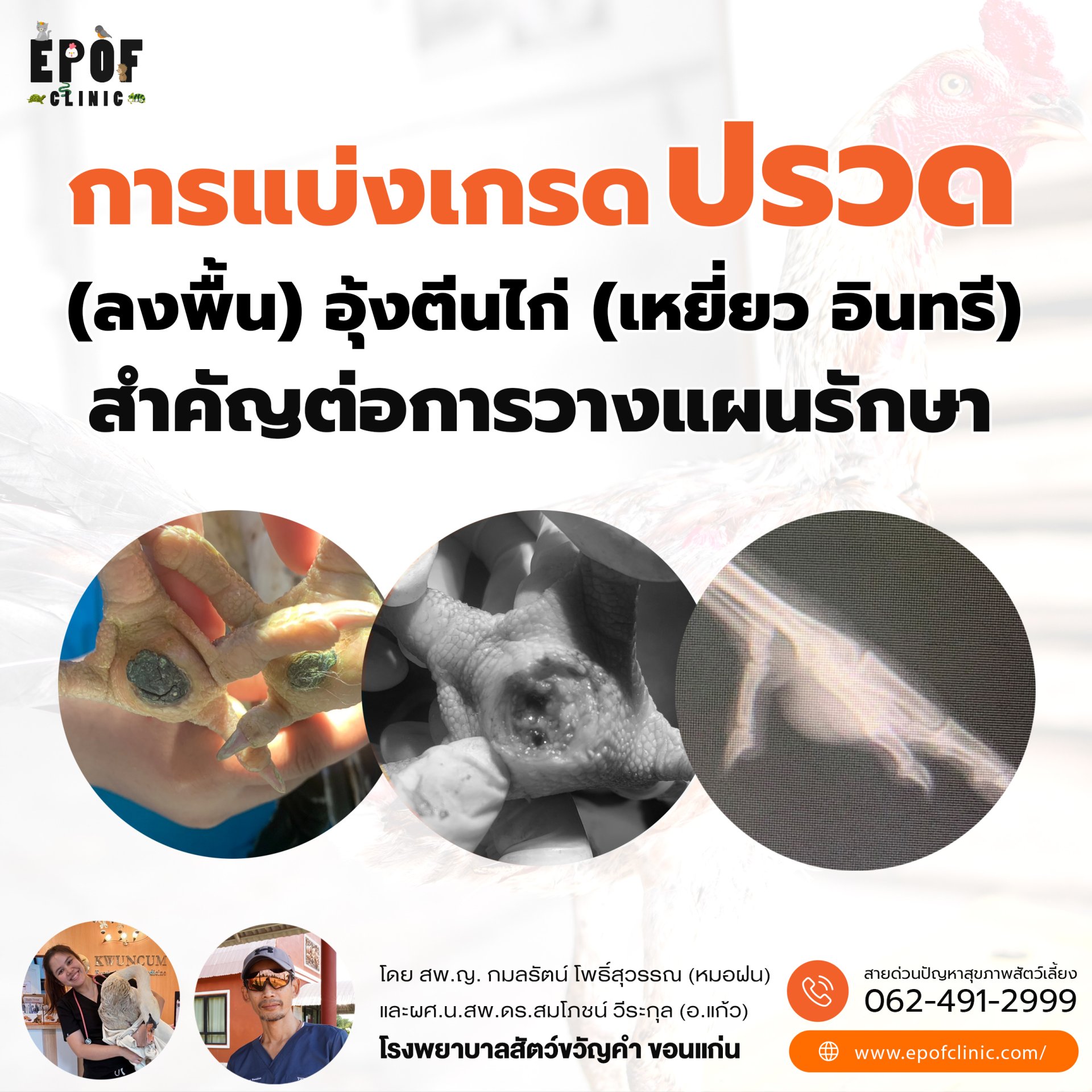 การแบ่งเกรดปรวด (ลงพื้น) อุ้งตีนไก่ (เหยี่ยว อินทรี) สำคัญต่อการวางแผนรักษา การแบ่งเกรดปรวด (ลงพื้น) อุ้งตีนไก่ (เหยี่ยว อินทรี) สำคัญต่อการวางแผนรักษา