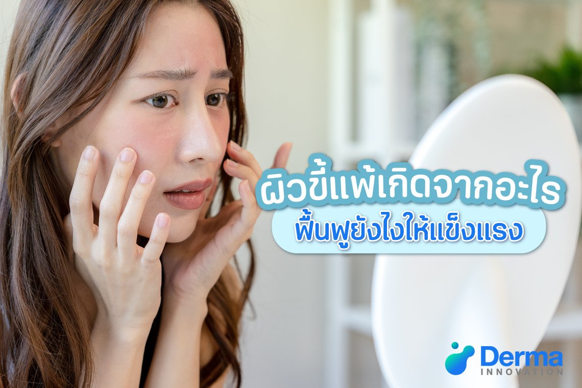 ผิวขี้แพ้เกิดจากอะไร ฟื้นฟูยังไงให้แข็งแรง ?