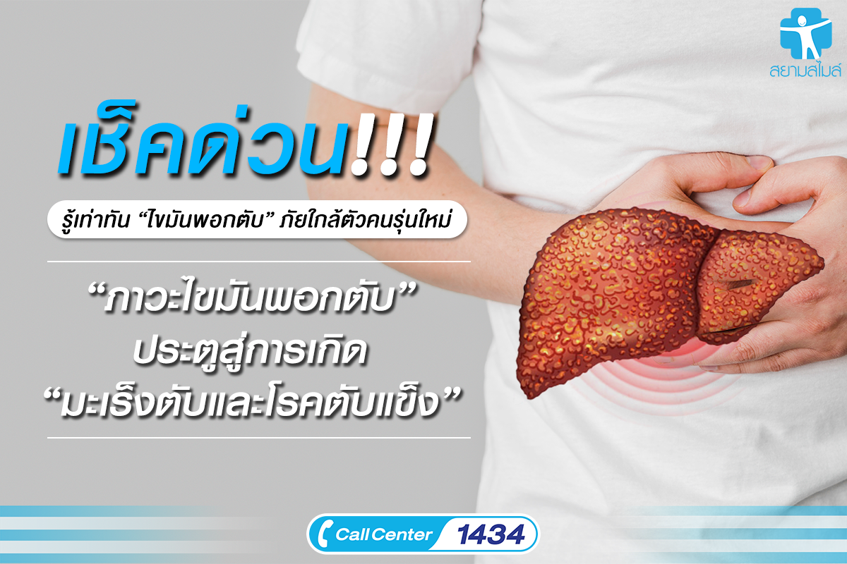 รู้เท่าทัน ‘ไขมันพอกตับ’ ภัยใกล้ตัวคนรุ่นใหม่