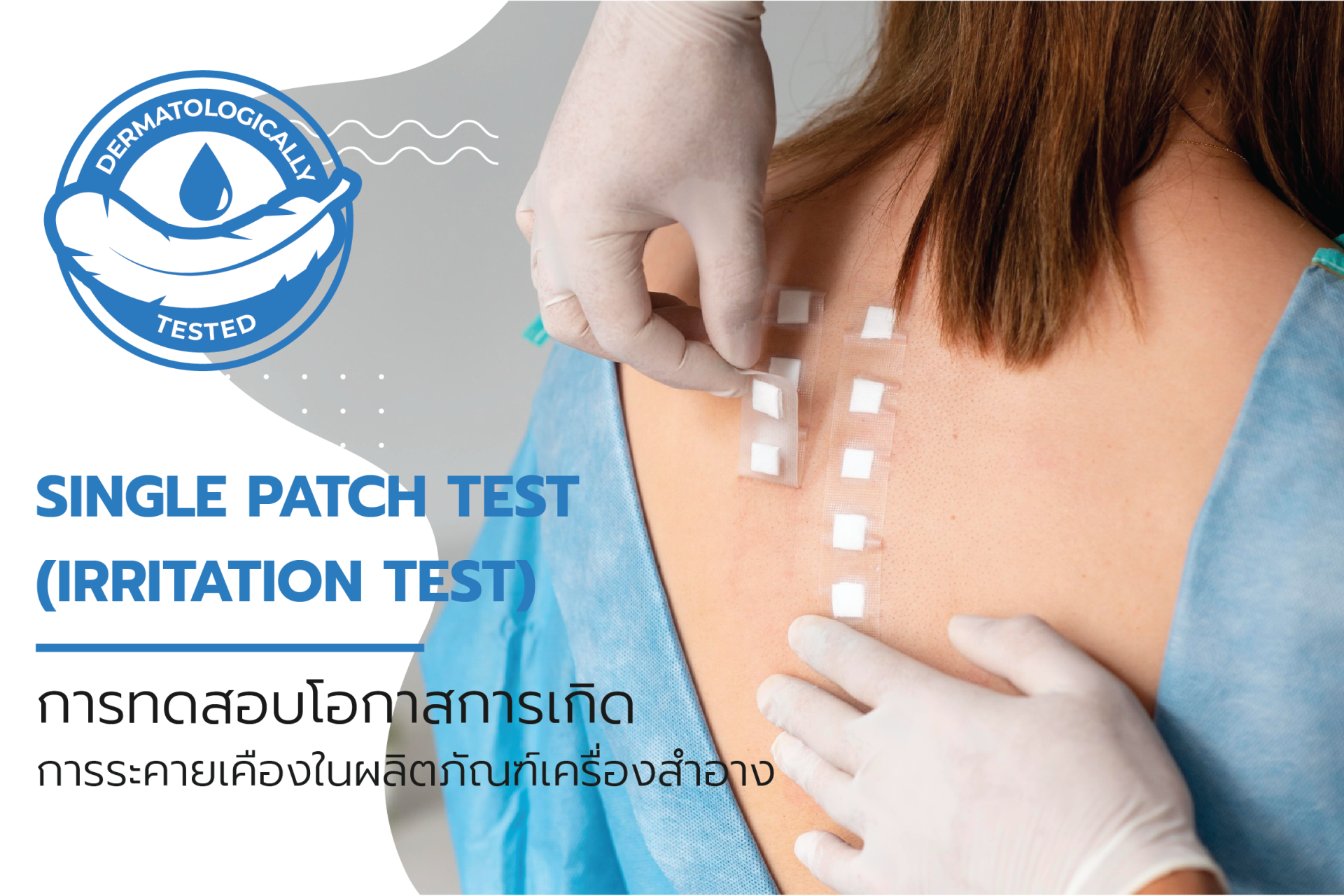 Patch Testing Positive Single patch test (Irritation test)
