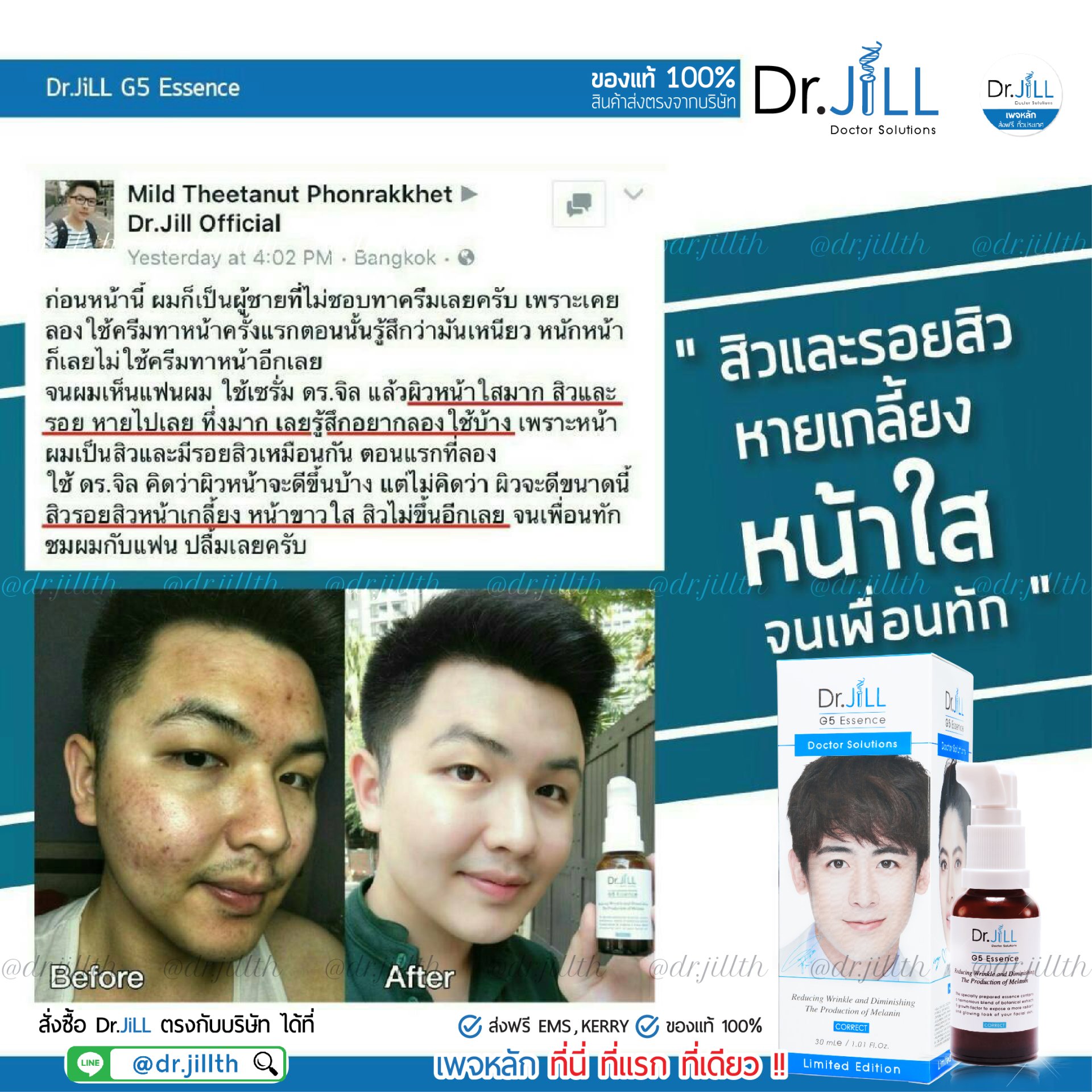 Dr JiLL รีวิว ผลการใช้จริง *สงวนสิทธิ์การนำภาพไปใช้โดยไม่ได้รับอนุญาต