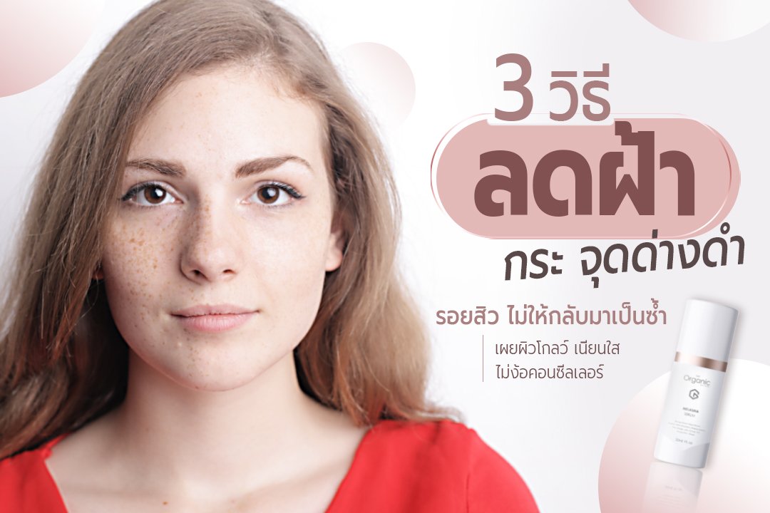 3 วิธีลดฝ้า กระ จุดด่างดำ รอยสิว ไม่ให้กลับมาเป็นซ้ำ เผยผิวโกลว์ เนียนใส  ไม่ง้อคอนซีลเลอร์ 3 วิธีลดฝ้า กระ จุดด่างดำ รอยสิว ไม่ให้กลับมาเป็นซ้ำ เผยผิวโกลว์ เนียนใส  ไม่ง้อคอนซีลเลอร์