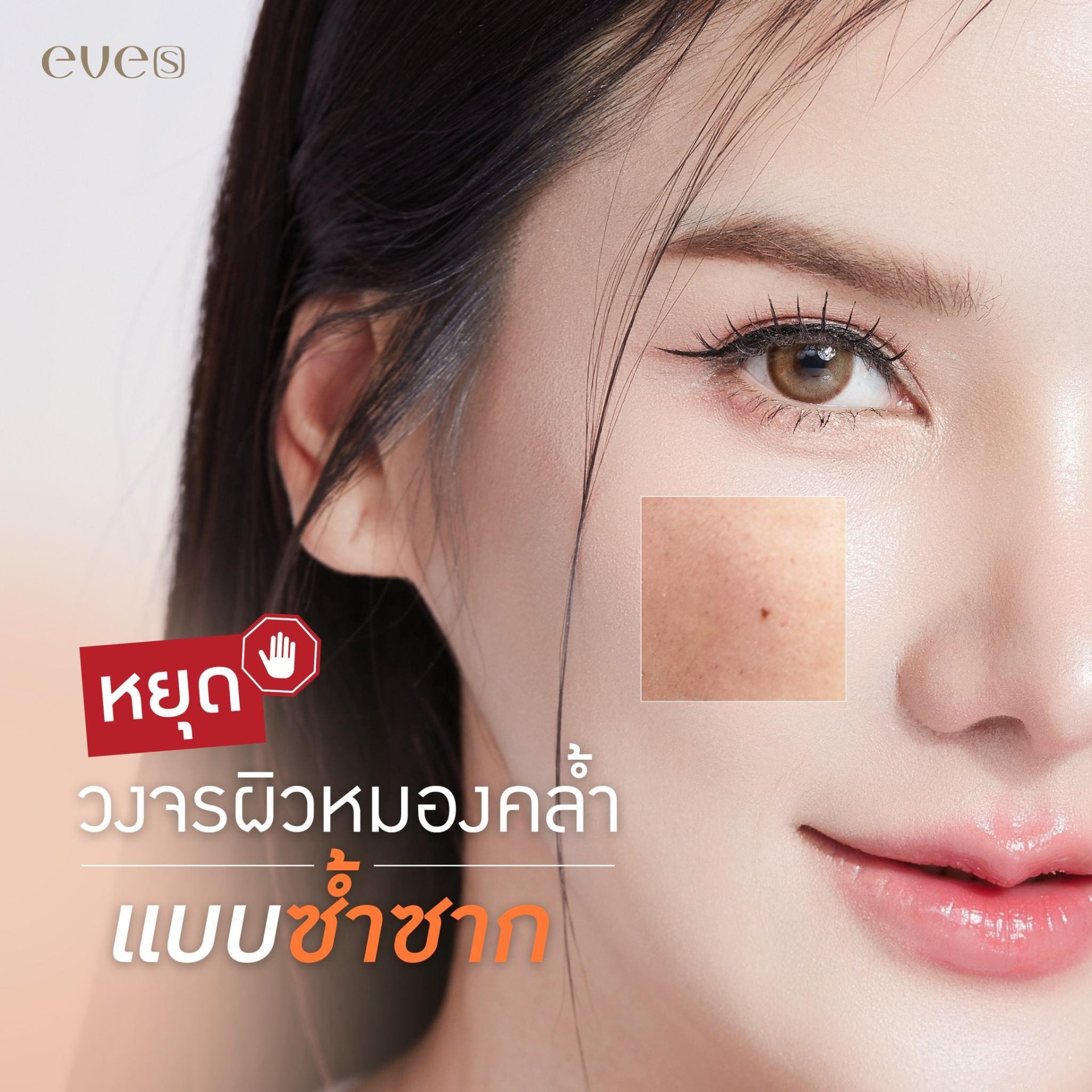 หยุดวงจรผิวหมองคล้ำแบบซ้ำซาก