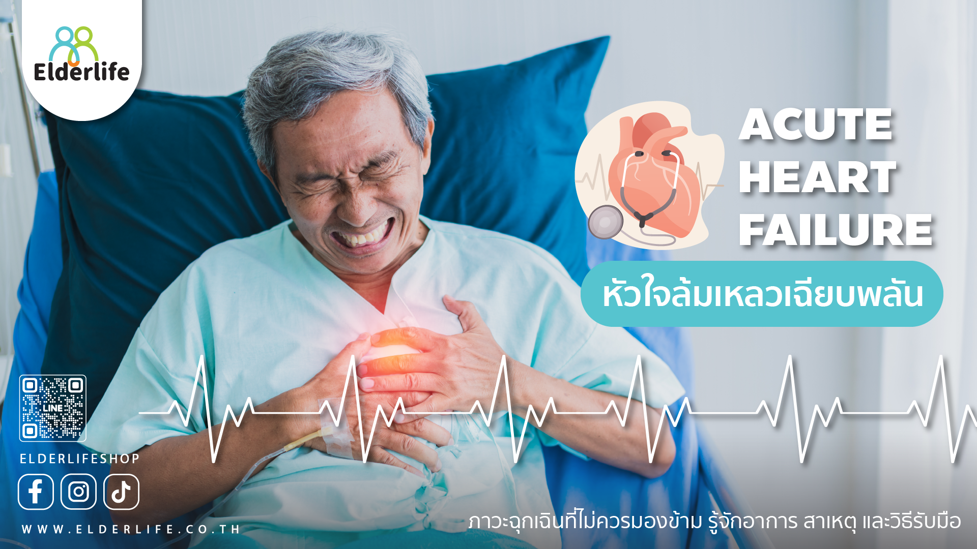 หัวใจล้มเหลวเฉียบพลัน ภาวะฉุกเฉินที่ไม่ควรมองข้าม