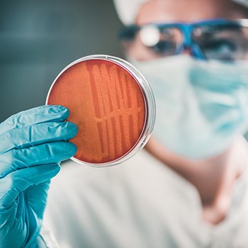 จำแนกเชื้อจุลินทรีย์ได้อย่างทันท่วงทีด้วยเทคนิค MALDI-TOF  MALDI-TOF for Rapid Microbial Identification  จำแนกเชื้อจุลินทรีย์ได้อย่างทันท่วงทีด้วยเทคนิค MALDI-TOF  MALDI-TOF for Rapid Microbial Identification