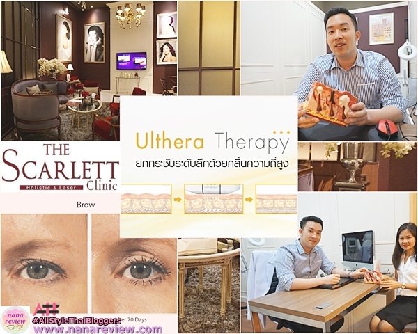 Ulthera Therapy The Scarlett Clinic 