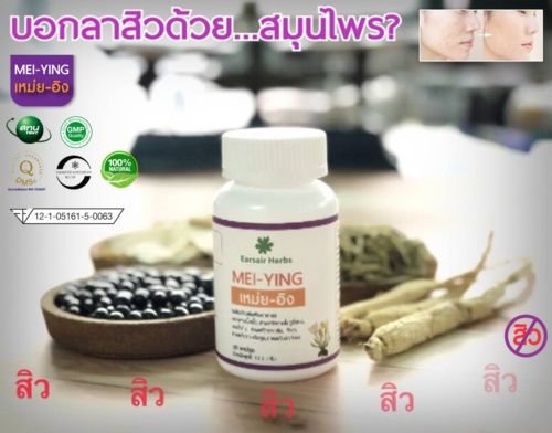 บอกลาสิวด้วยสมุนไพร บอกลาสิวด้วยสมุนไพร