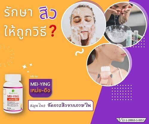 รักษาสิว ให้ถูกวิธี รักษาสิว ให้ถูกวิธี