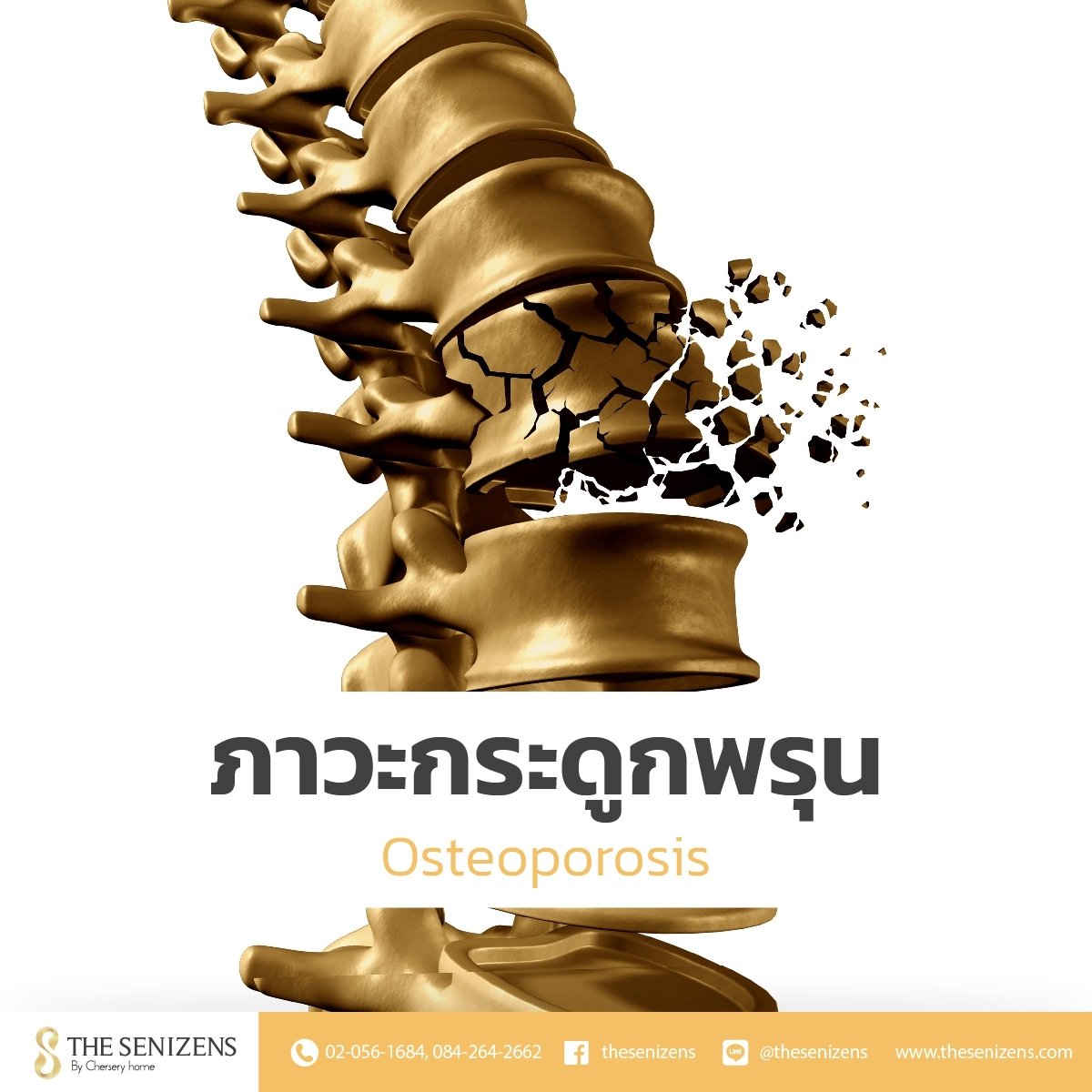 ภาวะกระดูกพรุน (Osteoporosis) - The Senizens