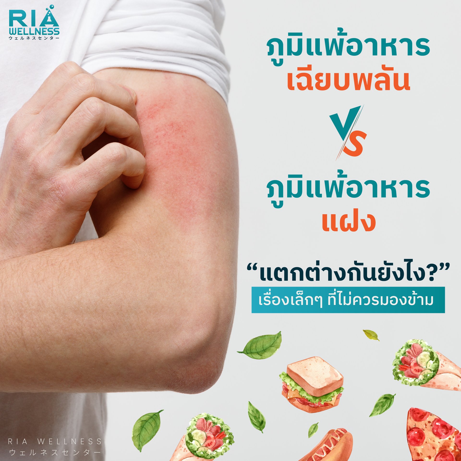ภูมิแพ้อาหารเฉียบพลัน  กับ ภูมิแพ้อาหารแฝง  ต่างกันอย่างไร? ภูมิแพ้อาหารเฉียบพลัน  กับ ภูมิแพ้อาหารแฝง  ต่างกันอย่างไร?