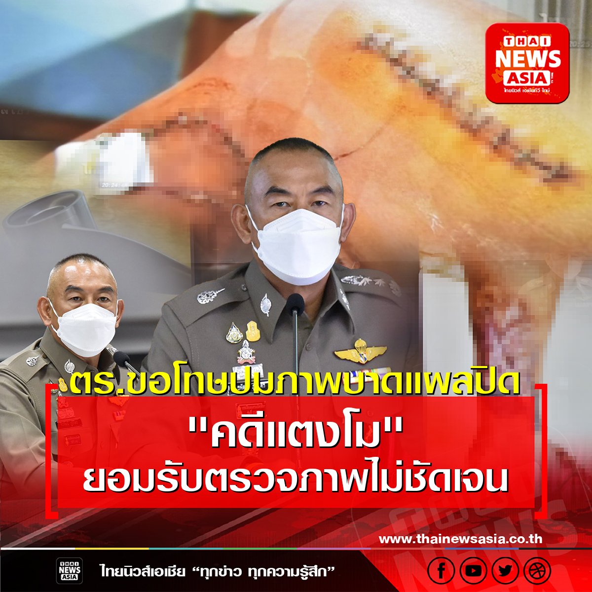 ตร.ขอโทษปมภาพบาดแผลปิด "คดีแตงโม" ยอมรับตรวจภาพไม่ชัดเจน