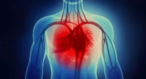 ลมเงียบ ลมปัจจุบัน heart attack ลมเงียบ ลมปัจจุบัน heart attack