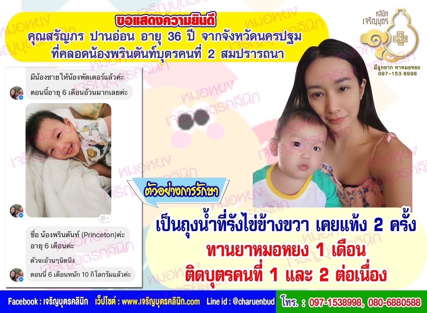 คุณสรัญภร ปานอ่อน อายุ 36 ปี จากจังหวัดนครปฐม ที่ได้คลอดน้องพรินตันท์บุตรคนที่ 2 เป็นที่เรียบร้อยแล้ว