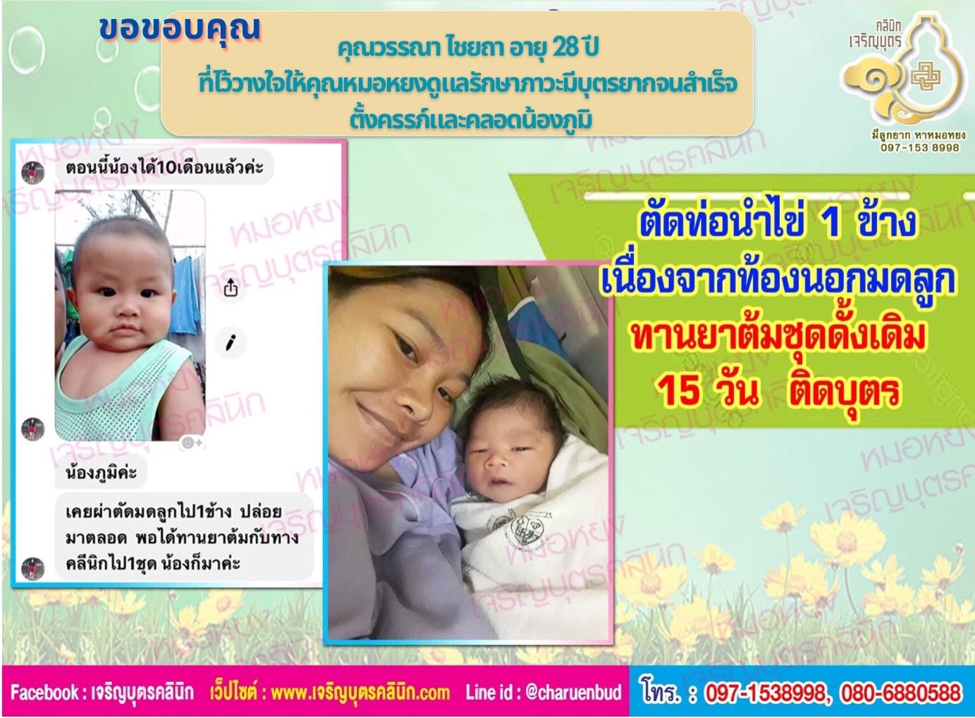 คุณวรรณา ไชยถา อายุ 28 ปี จากจังหวัดกรุงเทพฯ ที่ไว้วางใจให้คุณหมอหยงดูแลรักษาภาวะมีบุตรยากจนสำเร็จ