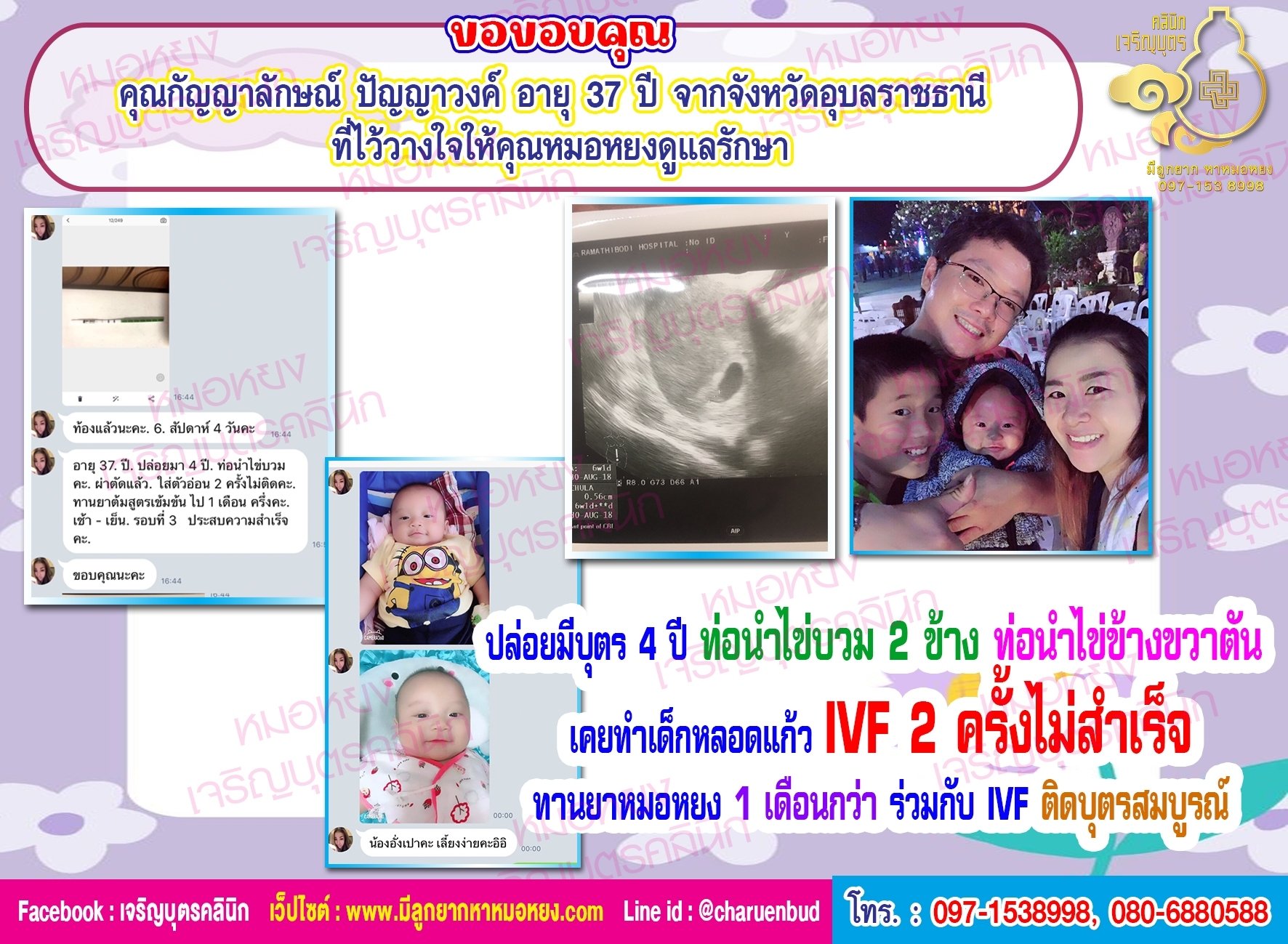 คุณกัญญาลักษณ์ ปัญญาวงค์ อายุ 37 ปี จากจังหวัดอุบลราชธานี ที่ไว้วางใจให้คุณหมอหยงดูแลรักษาจนสำเร็จตั้งครรภ์และคลอดน้องอั่งเปา อย่างสมบูรณ์แข็งแรง