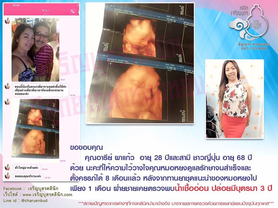 คุณอารีย์ ผาแก้วอายุ 28 ปี และสามีชาวญี่ปุ่นอายุ 68 ปี ที่ให้ความไว้วางใจคุณหมอหยงในการดูแลรักษาภาวะมีบุตรยากจนตั้งครรภ์ได้สมความปรารถนา