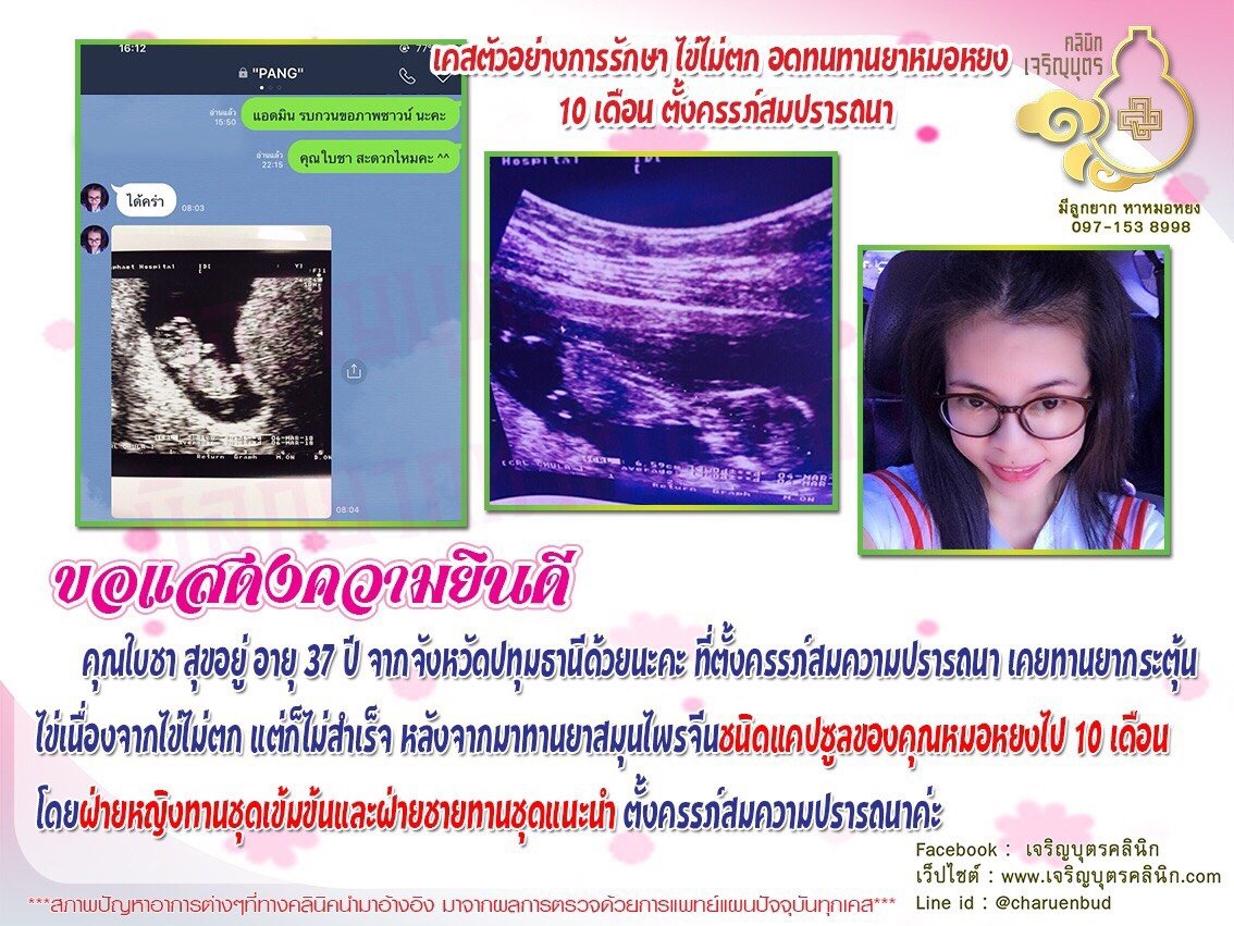 คุณใบชา สุขอยู่ อายุ 37 ปี จากจังหวัดปทุมธานี ได้ตั้งครรภ์สมความปรารถนา