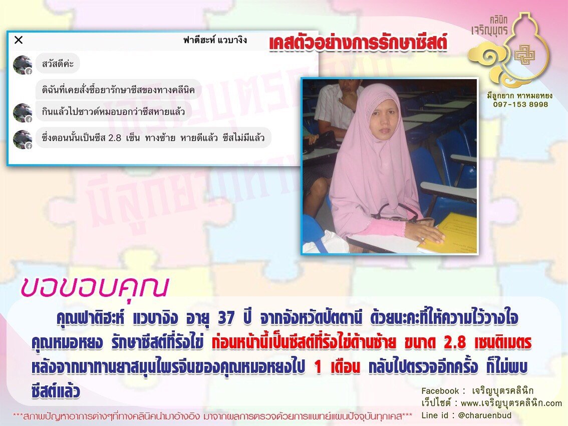 คุณฟาติฮะห์ แวบางิง อายุ 37 ปี จากจังหวัดปัตตานี ที่ให้ความไว้วางใจคุณหมอหยงรักษาซีสต์ที่รังไข่