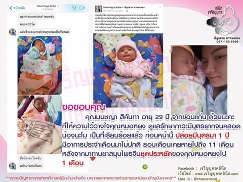 คุณมนชญา สีคันทา อายุ 29 ปี จากขอนแก่น ที่ให้ความไว้วางใจคุณหมอหยงดูแลรักษาภาวะมีบุตรยากจนคลอดน้องนะโม เป็นที่เรียบร้อยแล้ว