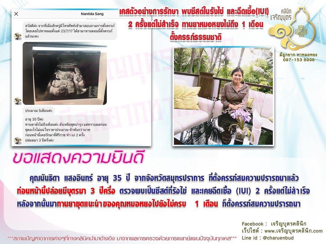 คุณนันธิดา แสงอินทร์ อายุ 35 ปี จากจังหวัดสมุทรปราการ ได้ตั้งครรภ์สมความปรารถนาแล้ว
