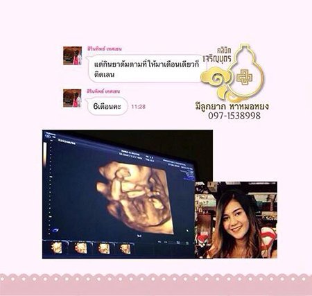 คุณสิรินทิพย์ เทศเซน อายุ34ปี ตอนนี้ตั้งครรภ์เเล้ว