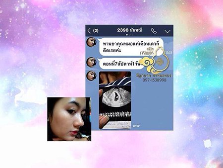 คุณนันทนี ธรรมรักษ์ ตอนนี้ตั้งครรภ์ 7 สัปดาห์แล้ว