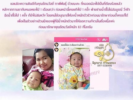 คุณรัตนวัลย์ กาฬพันธุ์ อายุ 34 ปี จากสงขลา คลอดน้องเป็นที่เรียบร้อยเเล้ว