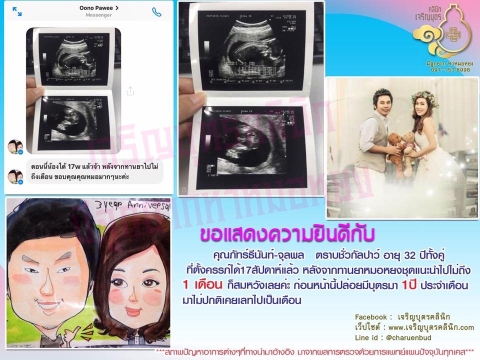 คุณภัทร์ธีนันท์-จุมพล ตราบชั่วกัลปาว์ อาย 32 ปีทั้งคู่ ที่ตั้งครรภ์ได้เเล้ว ปัจจุบันอายุครรภ์ 17 สัปดาห์
