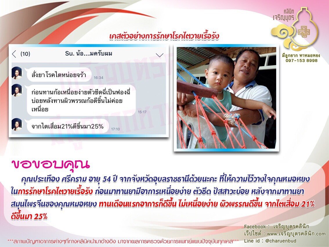 คุณประเทือง ศรีคราม อายุ 54 ปี จากจังหวัดอุบลราชธานี ที่ให้ความไว้วางใจคุณหมอหยงในการรักษาโรคไตวายเรื้อรัง