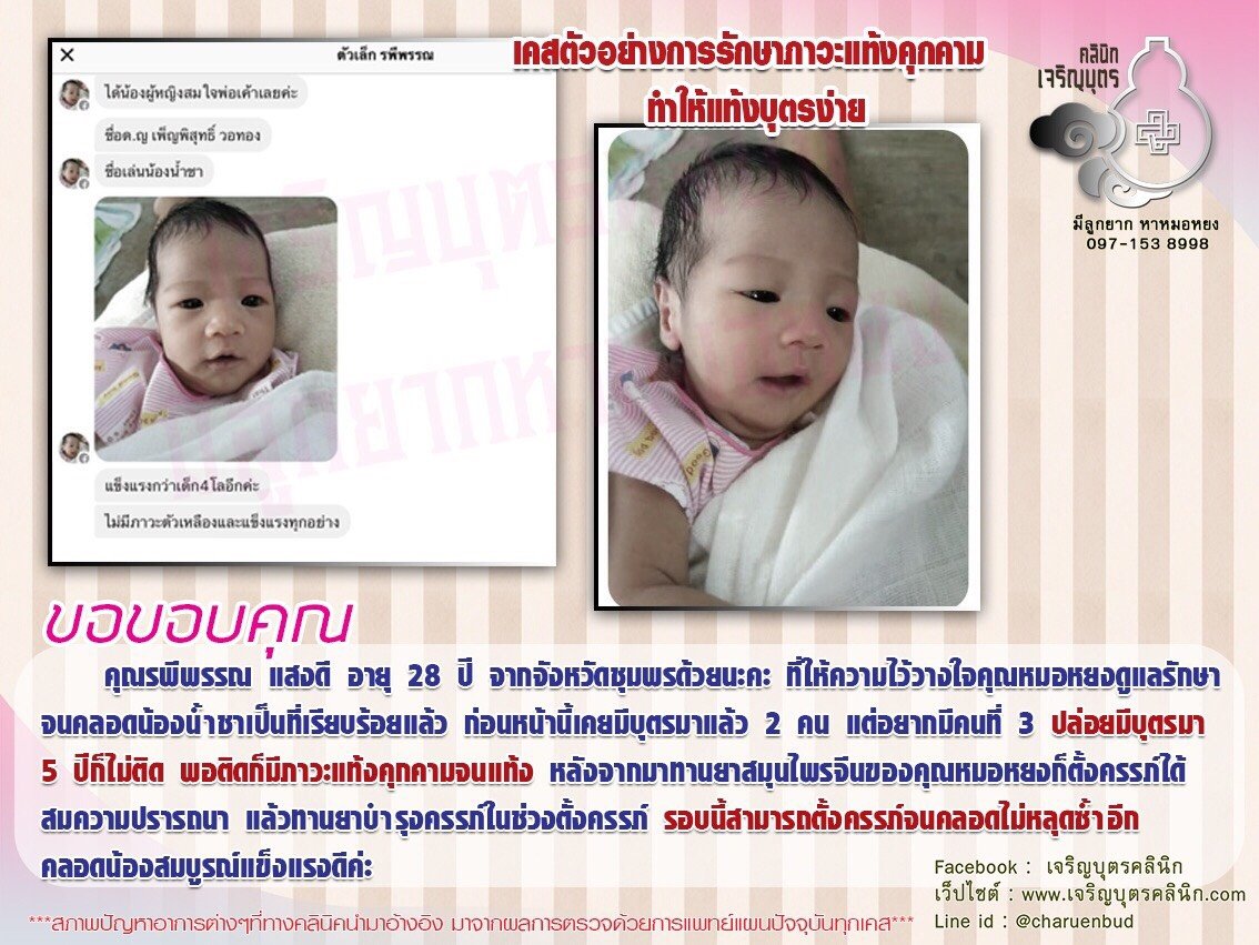 คุณรพีพรรณ แสงดี อายุ 28 ปี จากจังหวัดชุมพร ที่ให้ความไว้วางใจคุณหมอหยงดูแลรักษาจนคลอดน้องน้ำชาเป็นที่เรียบร้อยแล้ว 