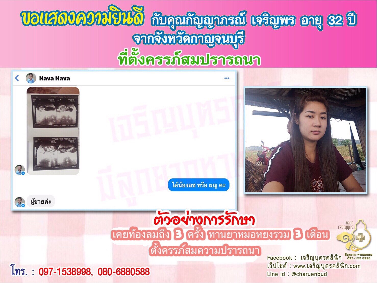 คุณกัญญาภรณ์ เจริญพร อายุ 32 ปี และคุณอุดมศักดิ์ รูปกลม อายุ 35 ปี จากกาญจนบุรีได้ตั้งครรภ์สมความปรารถนาแล้ว