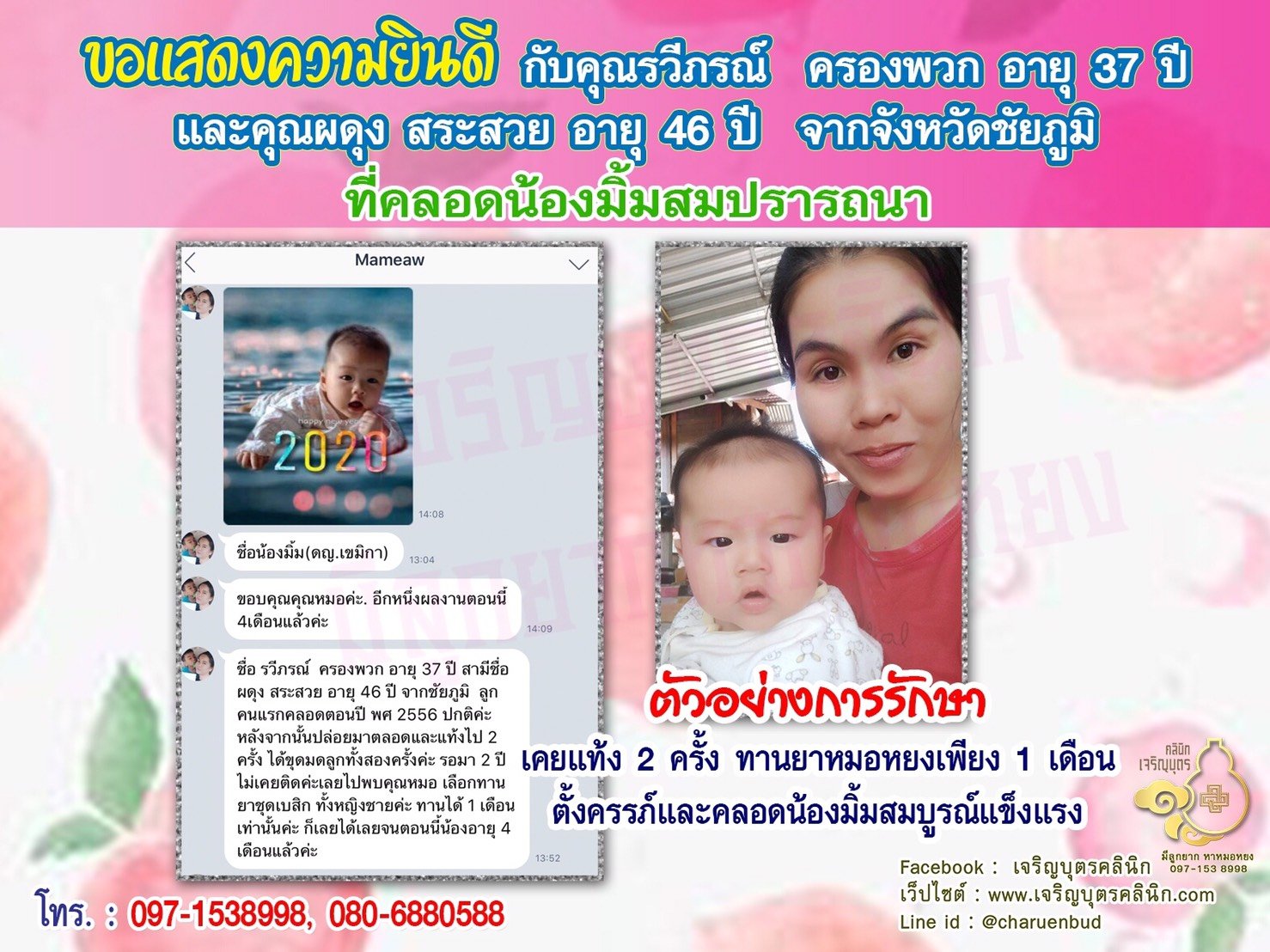 คุณรวีภรณ์ ครองพวก อายุ 37 ปี และคุณผดุง สระสวย อายุ 46 ปี จากชัยภูมิ ที่ได้คลอดน้องมิ้มเป็นที่เรียบร้อยแล้ว