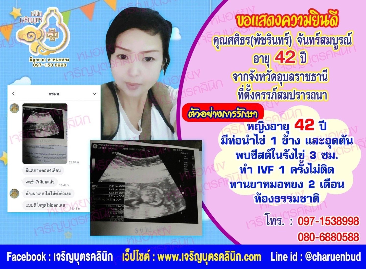 คุณพัชรินทร์ จันทรสมบูรณ์ อายุ 42 ปี และคุณสุทธิชาติ จันทร์สมบูรณ์ อายุ 43 ปี จากจังหวัดอุบลราชธานี ที่ได้ตั้งครรภ์สมความปรารถนาแล้ว