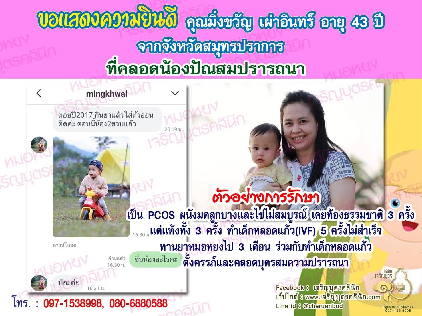 คุณมิ่งขวัญ เผ่าอินทร์ อายุ 43 ปี จากสมุทรปราการ ได้คลอดน้องปัณเป็นที่เรียบร้อยแล้ว ก่อนหน้ามาทานยารักษา ปล่อยมีบุตรมา 7 ปี ตรวจพบเป็น PCOS