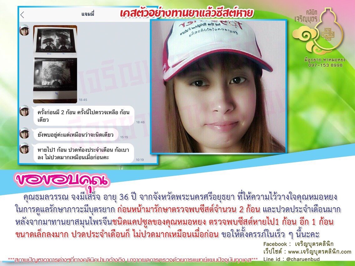 คุณธมลวรรณ จงมีเสร็จ อายุ 36 ปี จากจังหวัดพระนครศรีอยุธยา ที่ให้ความไว้วางใจคุณหมอหยงในการดูแลรักษาภาวะมีบุตรยาก