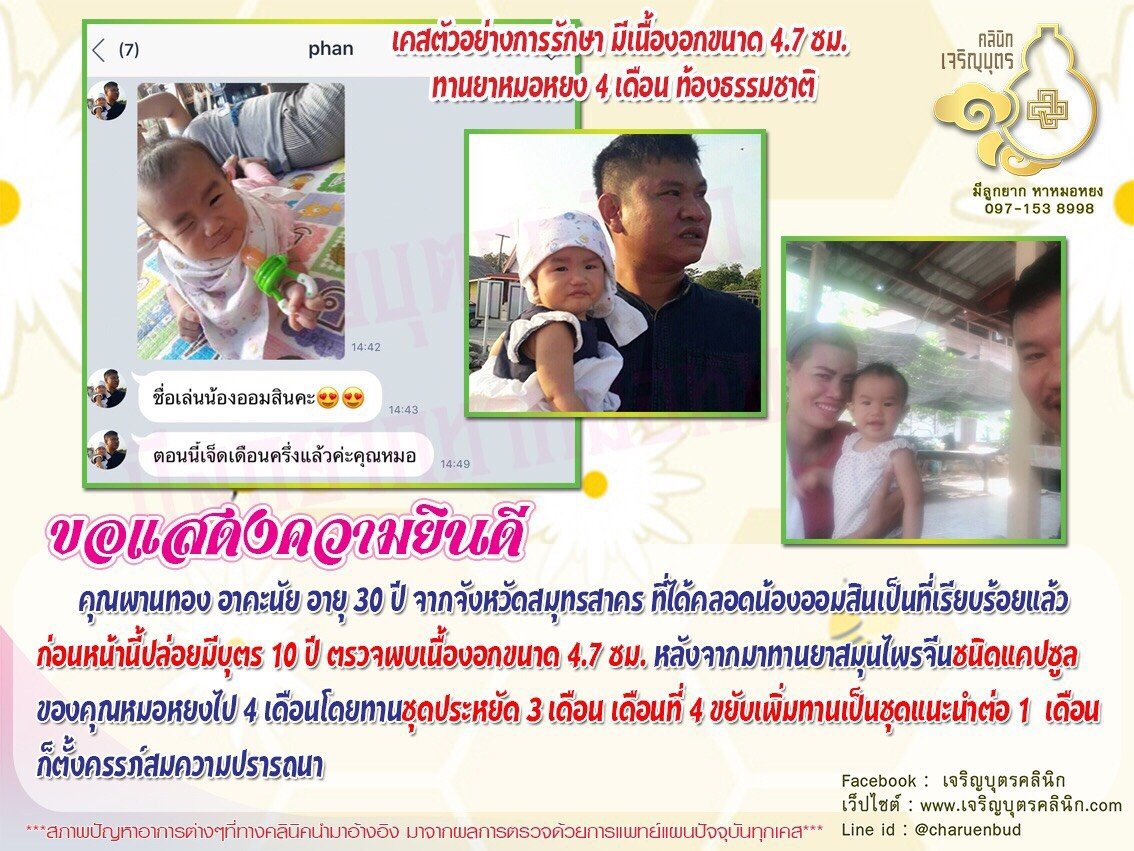 คุณพานทอง อาคะนัย อายุ 30 ปี จากจังหวัดสมุทรสาคร ที่ได้คลอดน้องออมสินเป็นที่เรียบร้อยแล้ว