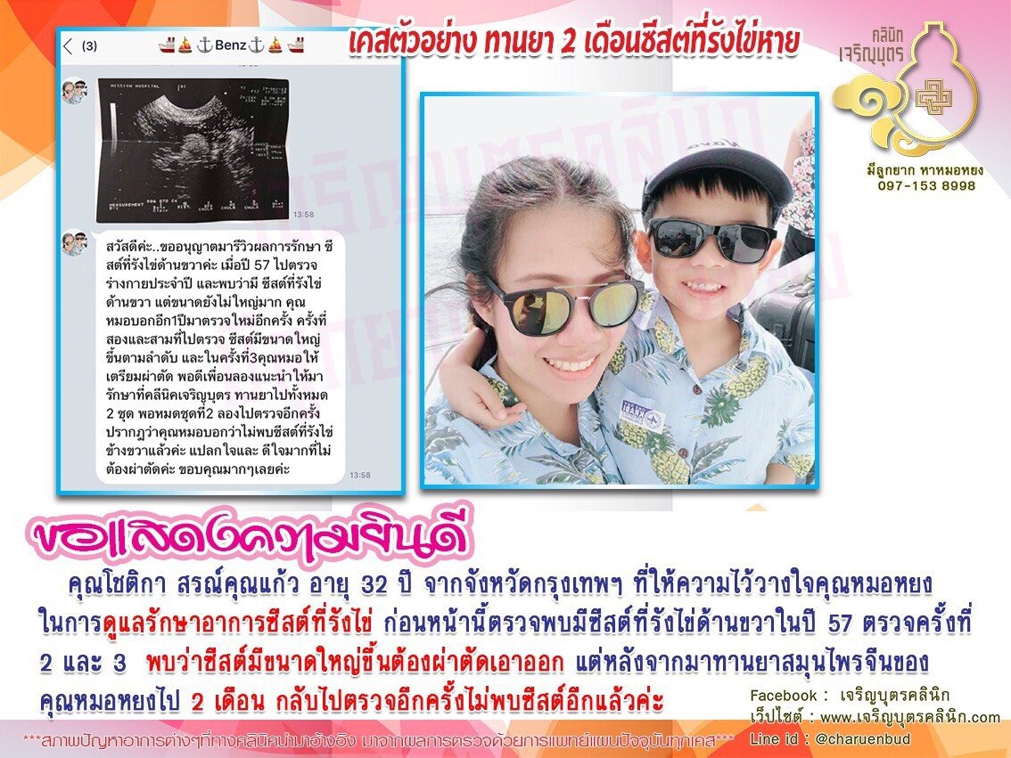 คุณโชติกา สรณ์คุณแก้ว อายุ 32 ปี จากจังหวัดกรุงเทพฯ ที่ให้ความไว้วางใจคุณหมอหยง ในการดูแลรักษาอาการซีสต์ที่รังไข่