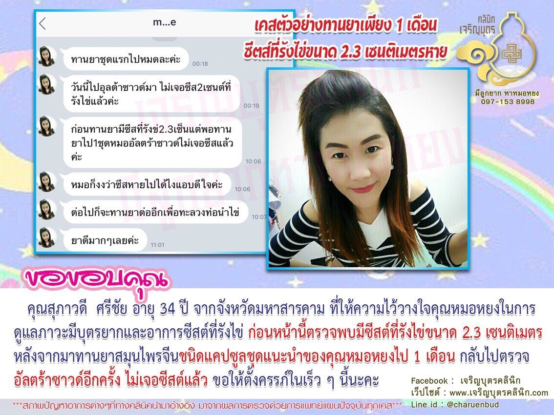 คุณสุภาวดี ศรีชัย อายุ 34 ปี จากจังหวัดมหาสารคาม ที่ให้ความไว้วางใจคุณหมอหยงในการดูแลภาวะมีบุตรยากและอาการซีสต์ที่รังไข่