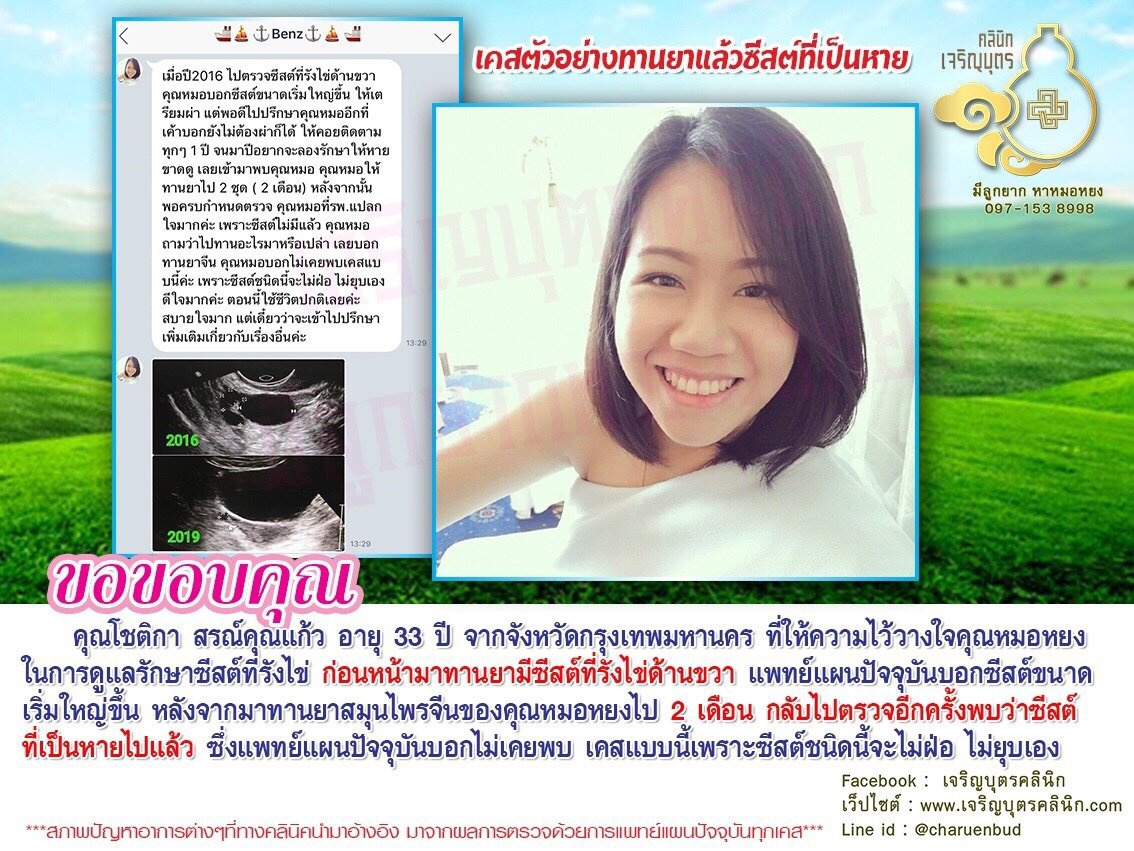 คุณโชติกา สรณ์คุณแก้ว อายุ 33 ปี จากจังหวัดกรุงเทพมหานคร ที่ให้ความไว้วางใจคุณหมอหยงในการดูแลรักษาซีสต์ที่รังไข่