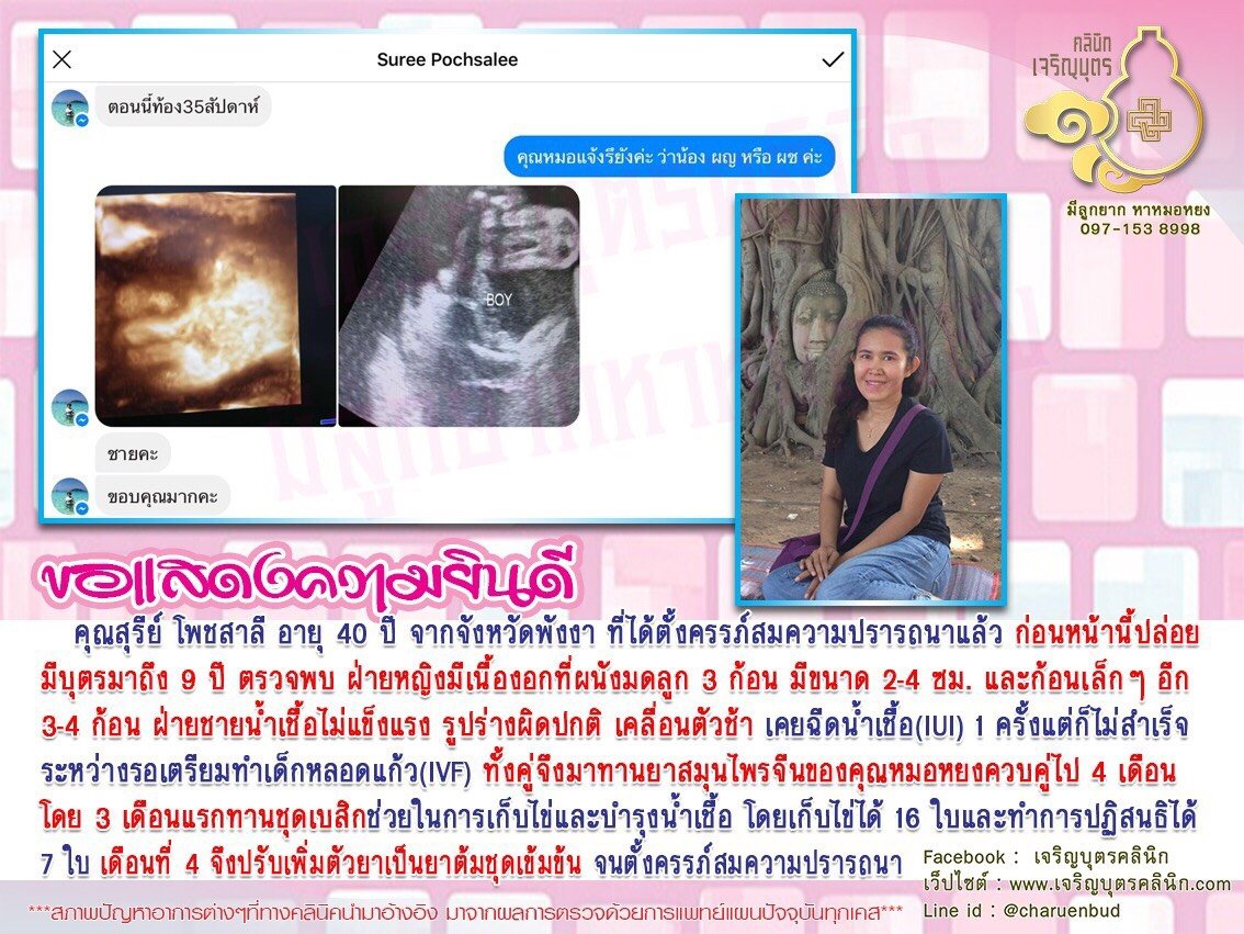 คุณสุรีย์ โพชสาลี อายุ 40 ปี จากจังหวัดพังงา ที่ได้ตั้งครรภ์สมความปรารถนาแล้ว