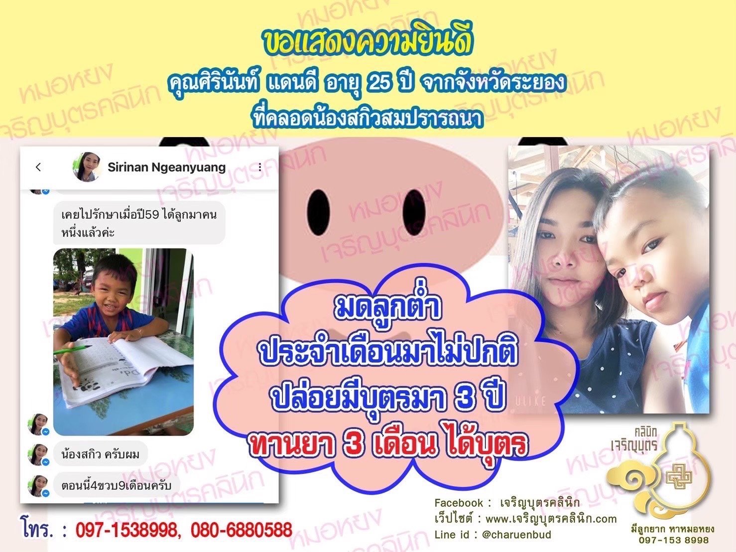 คุณศิรินันท์ แดนดี อายุ 25 ปี จากจังหวัดระยองด้วยนะคะ ที่ได้คลอดน้องสกิวเป็นที่เรียบร้อยเเล้ว (ปัจจุบันน้องอายุ 4 ขวบ 9 เดือน)