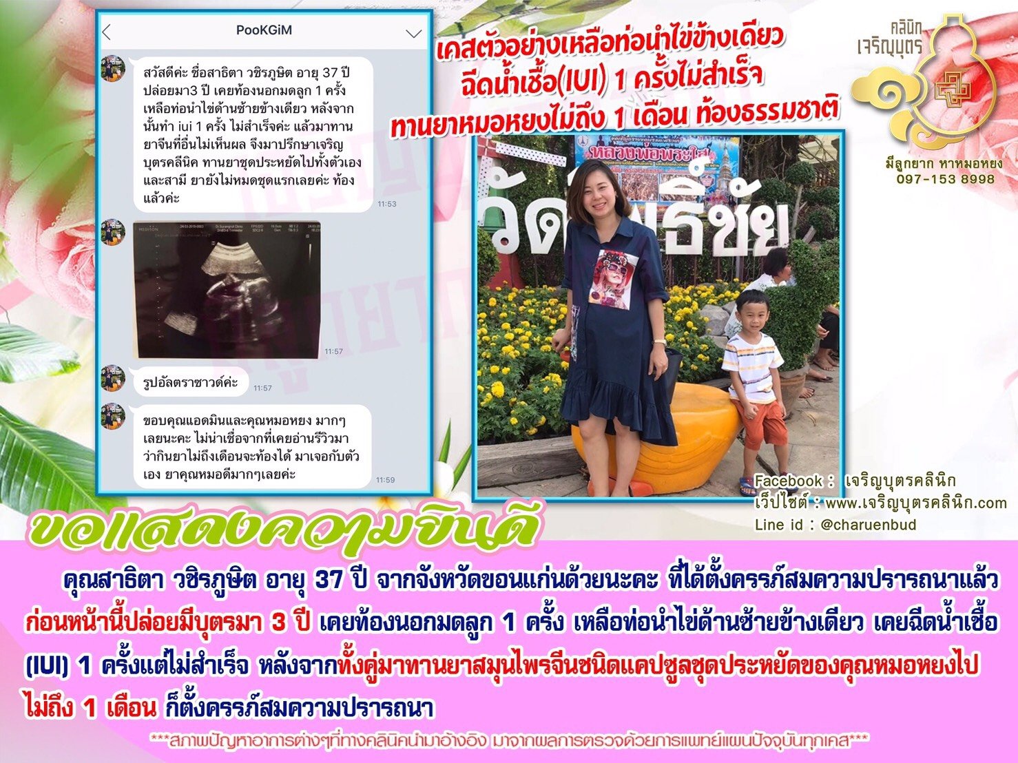 คุณสาธิตา วชิรภูษิต อายุ 37 ปี จากจังหวัดขอนแก่น ได้ตั้งครรภ์สมความปรารถนา