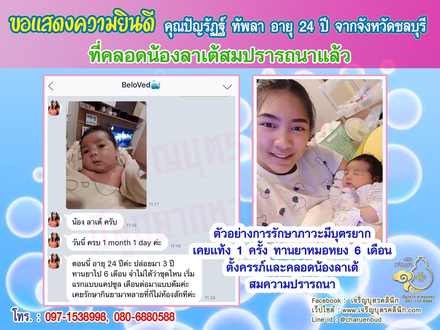 คุณปัญรัฏฐ์ ทัพลา อายุ 24 ปี จากจังหวัดชลบุรี ได้คลอดน้องลาเต้เป็นที่เรียบร้อยแล้ว