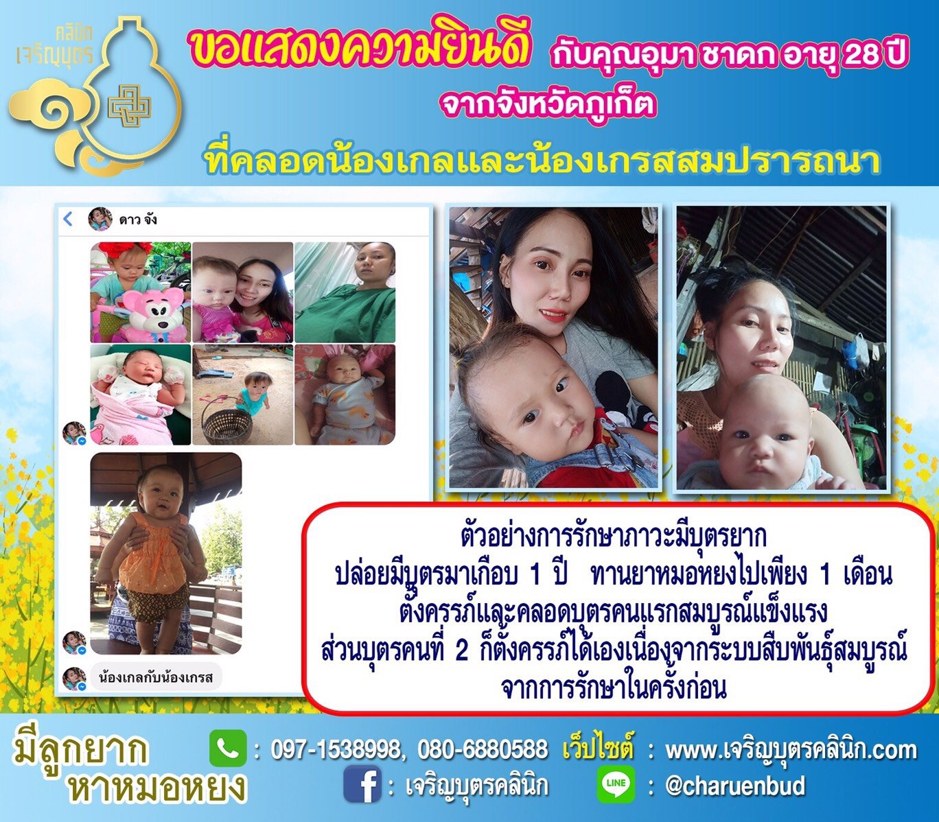 คุณอุมา ชาดก อายุ 28 ปี จากจังหวัดภูเก็ตที่ได้คลอดน้องเกลและน้องเกรสเรียบร้อยแล้ว