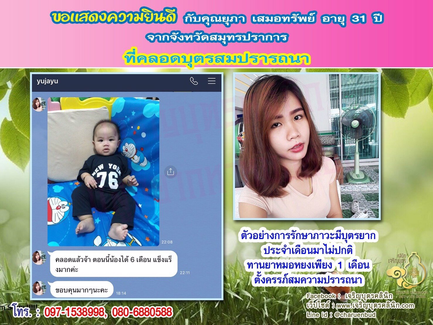 คุณยุภา เสมอทรัพย์ อายุ 31 ปี จากสมุทรปราการ ได้คลอดบุตรเป็นที่เรียบร้อยแล้ว