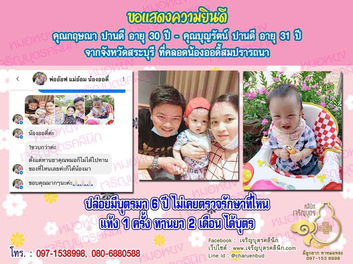 คุณกฤษณา ปานดี อายุ30 ปี และคุณบุญรัตน์ ปานดี อายุ 31 ปี จากสระบุรี ได้คลอดน้องออดี้เป็นที่เรียบร้อยแล้ว (ปัจจุบันน้องอายุได้ 1 ขวบกว่า)