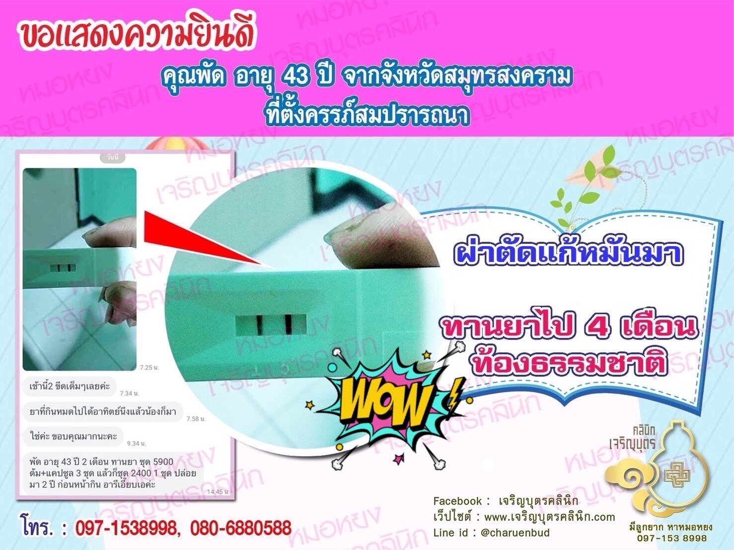 คุณพัด อายุ 43 ปีจากสมุทรสงคราม ที่ได้ตั้งครรภ์สมความปรารถนาแล้ว ก่อนหน้านี้ผ่าตัดแก้หมันและปล่อยมีบุตรมา 2 ปี