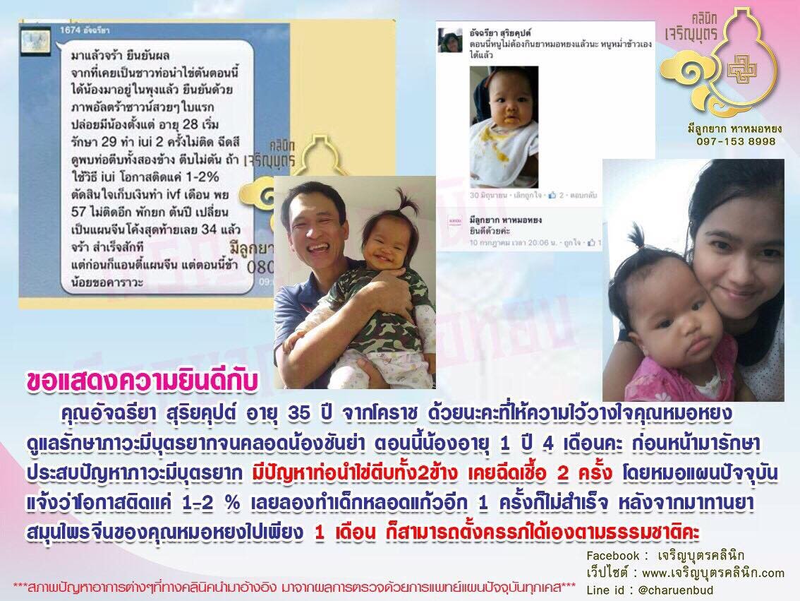 คุณอัจฉรียา สุริยคุปต์ อายุ 35 ปี จากโคราช ให้ความไว้วางใจคุณหมอหยงดูแลรักษาภาวะมีบุตรยากจนคลอดน้องชันย่า ตอนนี้น้องอายุ 1 ปี 4 เดือน